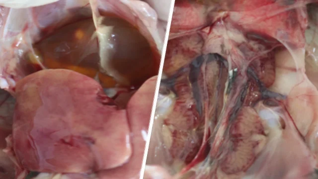 Hydropericardium Syndrome (HPS)