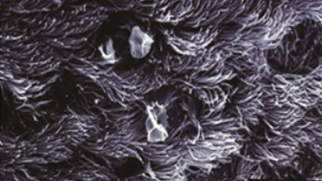 Respiratory tract inflammation: Normal cilia