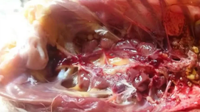 Reproductive tract inflammationFallopian tube inflammation