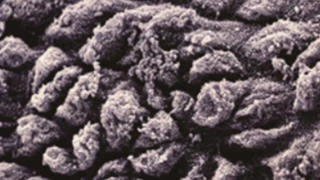 Respiratory tract inflammation and cilia affected by mycoplasma infection