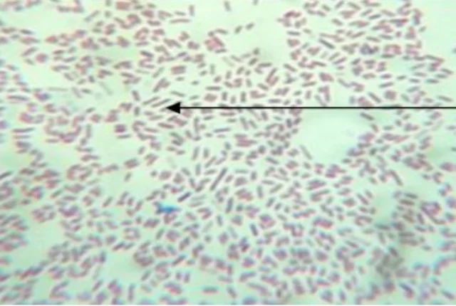 What Is Infectious Coryza in Chickens